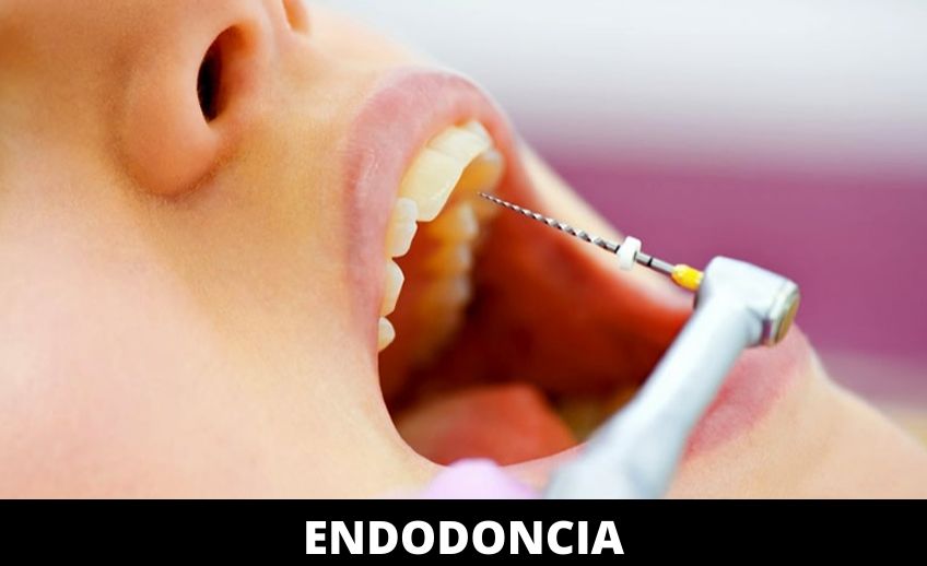 endodoncia(Dicosoft)