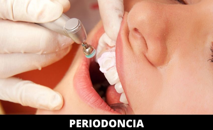 periodoncia(Dicosoft)